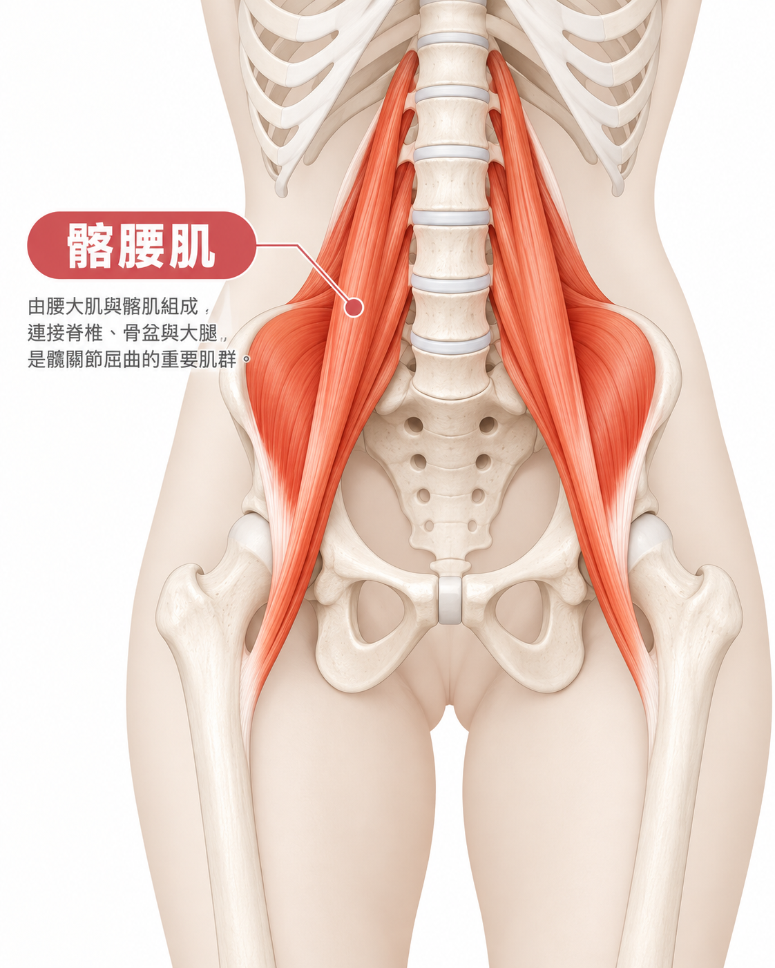 髂腰肌位置示意圖:由腰椎與骨盆延伸至大腿近端